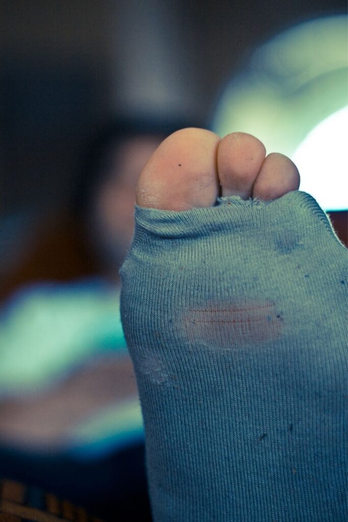 What to do with old socks should be as breezy as the holes in the heels… right? Image by AlkeMade from Pixabay #whattodowitholdsocks #whattodowitholdmismatchedsocks #whattodowitholdwoolsocks #whattodowitholdsockswithholes #sustainablejungle